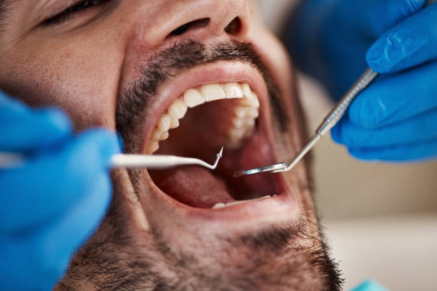 Best Cracked Tooth Emergency Dentist  in Atkins, IA