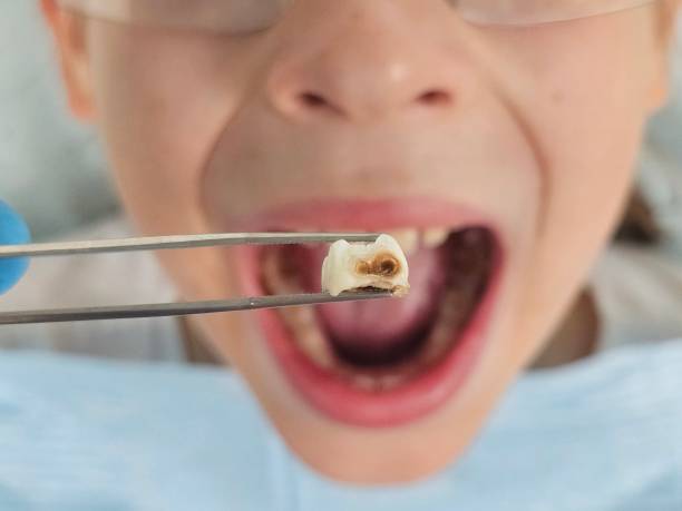 Best Emergency Pediatric Dentist  in Atkins, IA